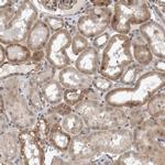 PARG1 Antibody in Immunohistochemistry (IHC)