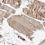 CCBL2 Polyclonal Antibody