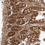 ZNF649 Antibody in Immunohistochemistry (Paraffin) (IHC (P))
