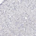 CDH17 Antibody in Immunohistochemistry (IHC)