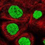 ALPK3 Antibody in Immunocytochemistry (ICC/IF)