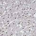 ALPK3 Antibody in Immunohistochemistry (IHC)