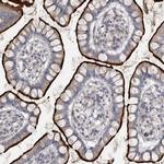 OPLAH Polyclonal Antibody