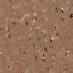 PITPNC1 Polyclonal Antibody