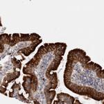 LRRC40 Antibody in Immunohistochemistry (Paraffin) (IHC (P))