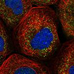 RABGGTB Polyclonal Antibody