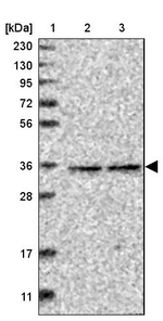 RABGGTB Antibody in Western Blot (WB)
