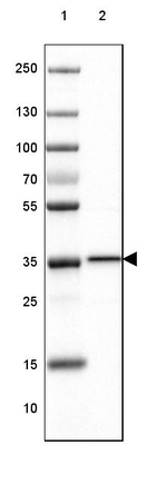 RABGGTB Antibody in Western Blot (WB)