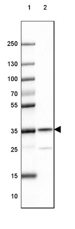 RABGGTB Antibody in Western Blot (WB)