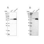 P4HA1 Antibody in Western Blot (WB)