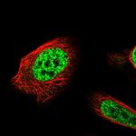 API5 Polyclonal Antibody