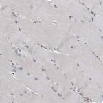 LMAN2L Antibody in Immunohistochemistry (Paraffin) (IHC (P))