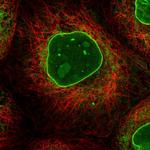 RBMX2 Polyclonal Antibody