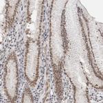 RBMX2 Antibody in Immunohistochemistry (Paraffin) (IHC (P))