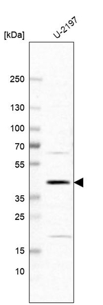RBMX2 Antibody in Western Blot (WB)