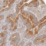 C13orf18 Antibody in Immunohistochemistry (Paraffin) (IHC (P))