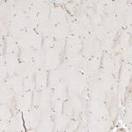 C13orf18 Antibody in Immunohistochemistry (Paraffin) (IHC (P))