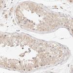 C13orf18 Antibody in Immunohistochemistry (Paraffin) (IHC (P))
