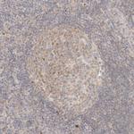 C13orf18 Antibody in Immunohistochemistry (Paraffin) (IHC (P))