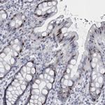 VWDE Antibody in Immunohistochemistry (Paraffin) (IHC (P))