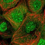 ANKMY1 Polyclonal Antibody