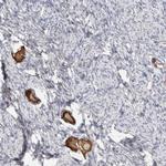 ANKMY1 Antibody in Immunohistochemistry (Paraffin) (IHC (P))