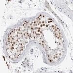 Casc5 Antibody in Immunohistochemistry (Paraffin) (IHC (P))