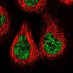 NCAPG2 Polyclonal Antibody