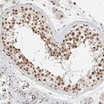 NCAPG2 Antibody in Immunohistochemistry (IHC)