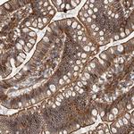 AHNAK Antibody in Immunohistochemistry (Paraffin) (IHC (P))
