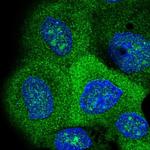 VEPH1 Polyclonal Antibody