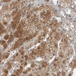 VEPH1 Antibody in Immunohistochemistry (Paraffin) (IHC (P))