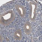 VEPH1 Antibody in Immunohistochemistry (Paraffin) (IHC (P))