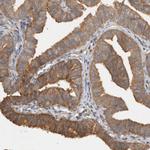 VEPH1 Antibody in Immunohistochemistry (Paraffin) (IHC (P))