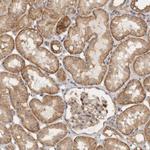 VEPH1 Antibody in Immunohistochemistry (Paraffin) (IHC (P))