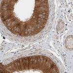 VEPH1 Antibody in Immunohistochemistry (IHC)
