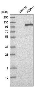 VEPH1 Antibody in Western Blot (WB)