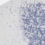 IFI30 Antibody in Immunohistochemistry (Paraffin) (IHC (P))