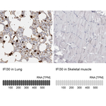 IFI30 Antibody in Immunohistochemistry (Paraffin) (IHC (P))