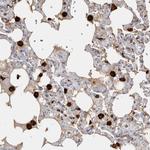 IFI30 Antibody in Immunohistochemistry (Paraffin) (IHC (P))