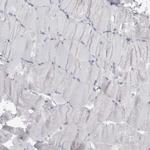 IFI30 Antibody in Immunohistochemistry (Paraffin) (IHC (P))