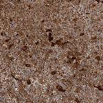 IFI30 Antibody in Immunohistochemistry (Paraffin) (IHC (P))