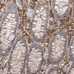 CCDC88B Antibody in Immunohistochemistry (Paraffin) (IHC (P))