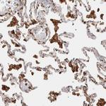CCDC88B Antibody in Immunohistochemistry (Paraffin) (IHC (P))