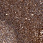 CCDC88B Polyclonal Antibody