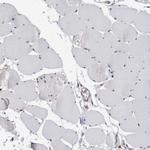 CCDC88B Antibody in Immunohistochemistry (Paraffin) (IHC (P))