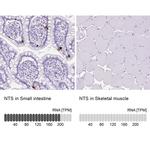 NTS Polyclonal Antibody