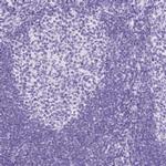 NTS Antibody in Immunohistochemistry (IHC)
