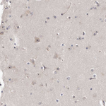 RBM28 Antibody in Immunohistochemistry (Paraffin) (IHC (P))