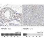 RBM28 Antibody in Immunohistochemistry (IHC)